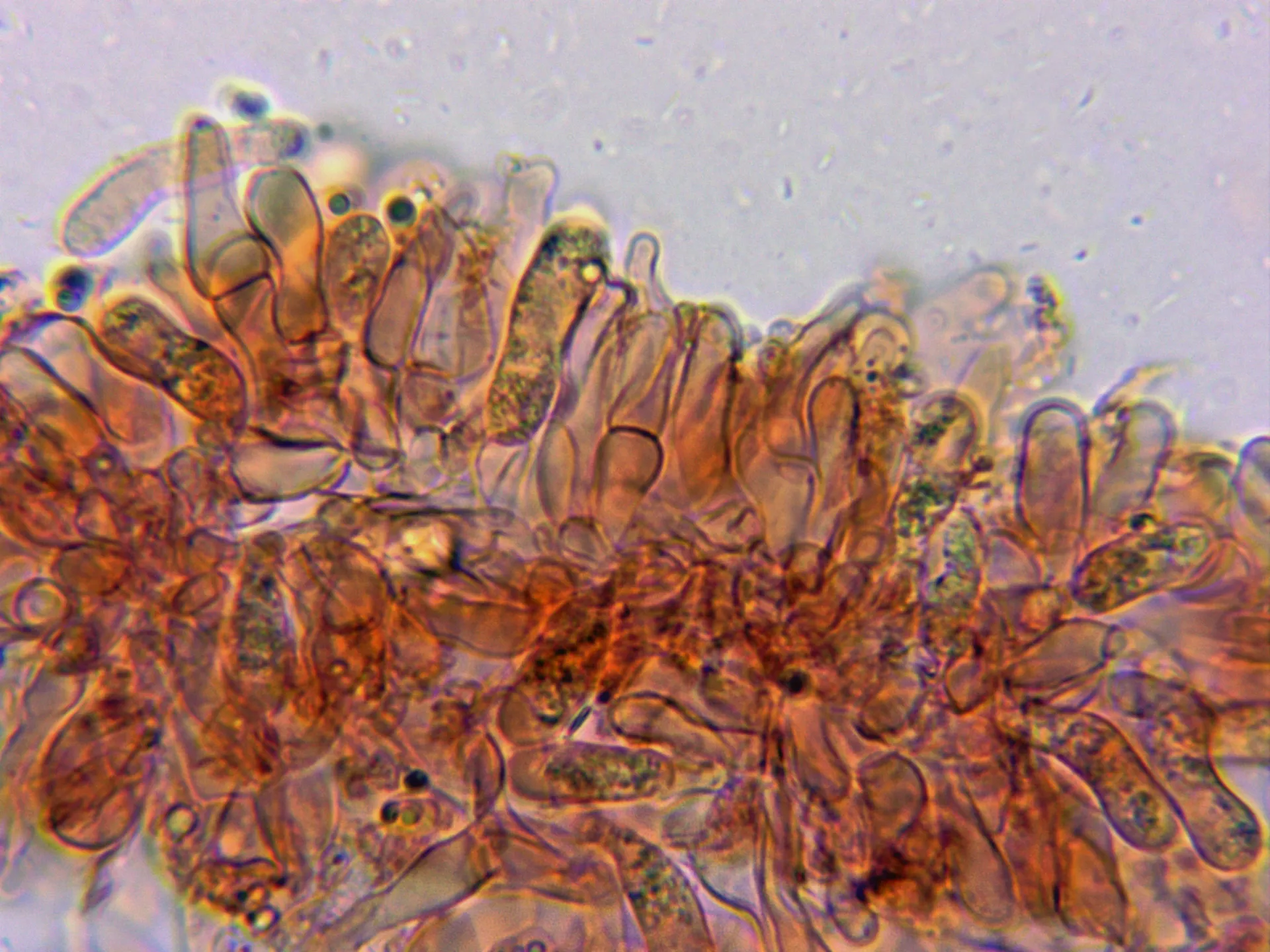Microscopía de Tricholoma scalpturatum - 10 - Arista laminar 2